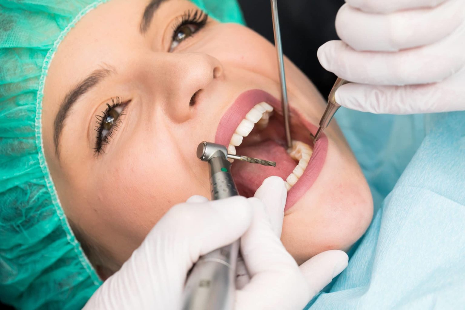 Implants dentaires à Genève