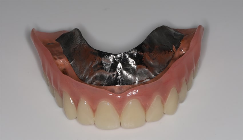 Prothèses dentaires amovibles - CMD Balexert
